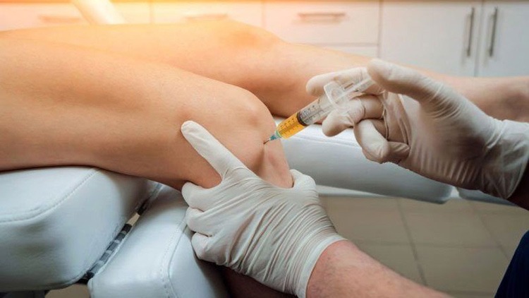  Hút và xét nghiệm dịch khớp cho phép bác sĩ phát hiện chính xác về sự viêm nhiễm, tổn thương trong khớp