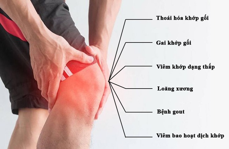  Giải mã đầu gối kêu lục cục là bệnh gì