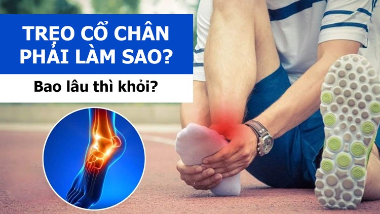  Bị trẹo cổ thì chân phải làm sao? Bao thì lâu khỏi?