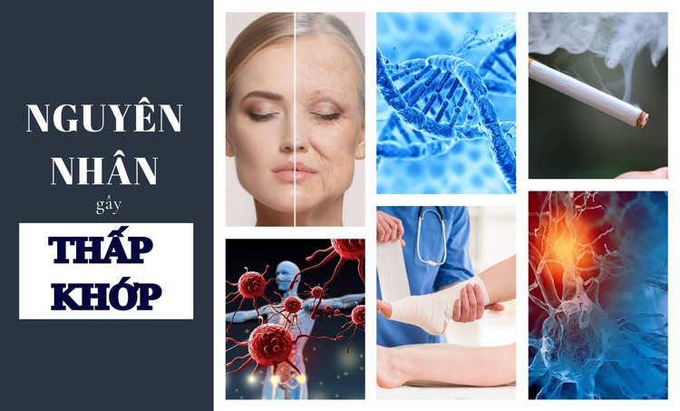  Các nguyên nhân phổ biến gây thấp khớp ở trẻ em và người lớn