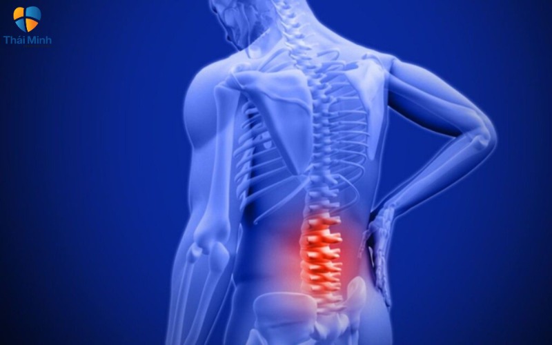  Vôi hoá cột sống hoàn toàn có thể chữa được nếu điều trị kịp thời