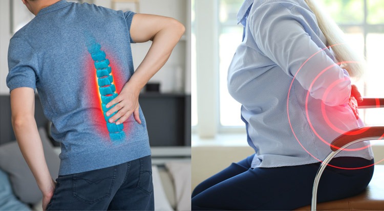  Khi di chuyển mà cảm thấy đau đớn có thể là triệu chứng thoát vị đĩa đệm cột sống