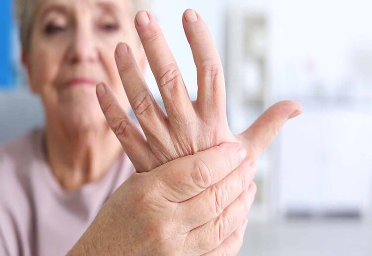  Cứng khớp là một triệu chứng điển hình của bệnh viêm khớp