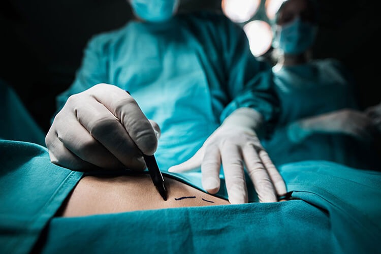 Căn bệnh thoát vị đĩa đệm tái phát