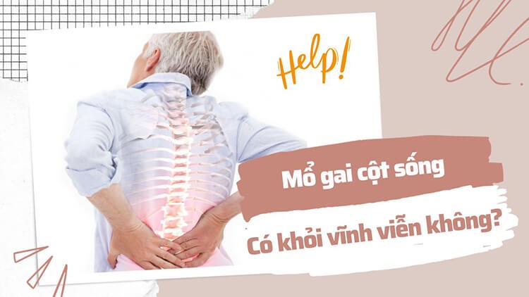Mổ gai cột sống có nguy hiểm không