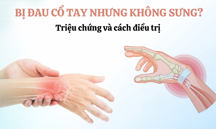  Giải đáp thắc mắc đau cổ tay nhưng lại không sưng