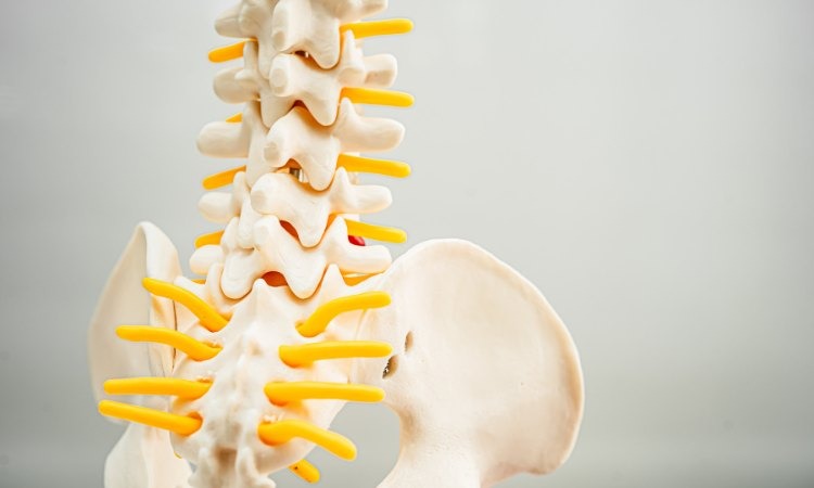  Thoái hóa cột sống tạo ra những cơn đau âm ỉ