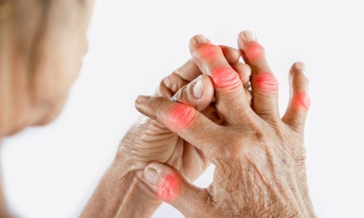  Dược liệu có tác dụng giảm triệu chứng thấp khớp