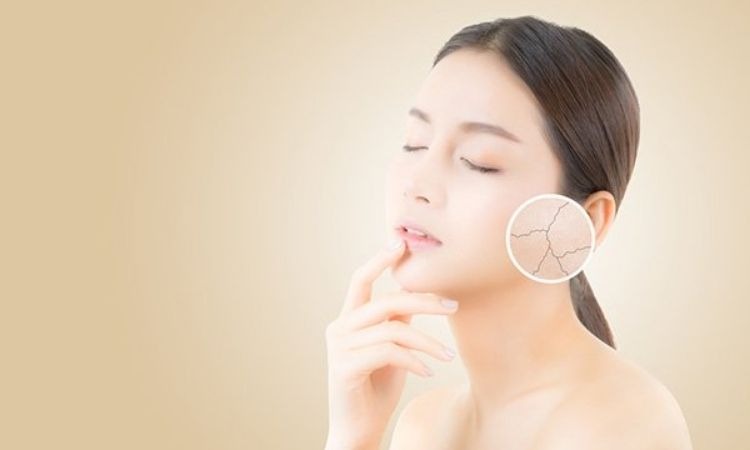  Hỗ trợ ngăn ngừa lão hóa da