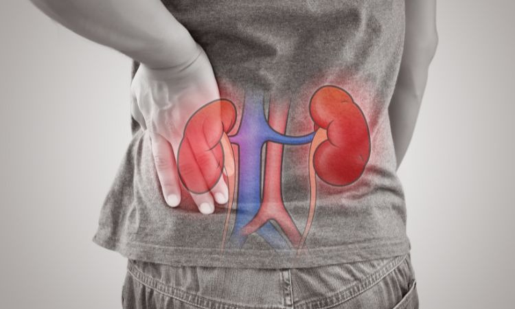  Nhiễm trùng thận trái có thể làm đau nhức vùng thắt lưng bên trái
