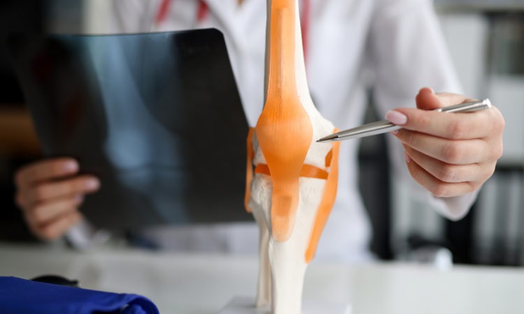  Chẩn đoán lỏng khớp gối bằng hình ảnh