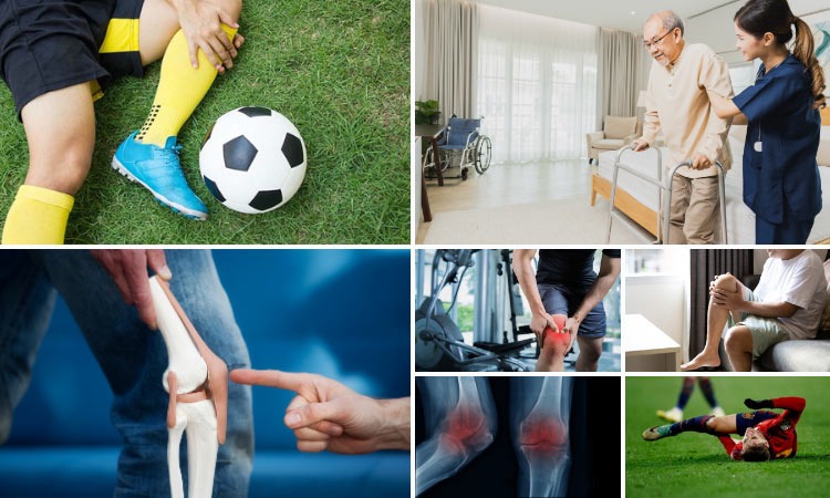  Các nguyên nhân phổ biến khiến khớp gối bị lỏng