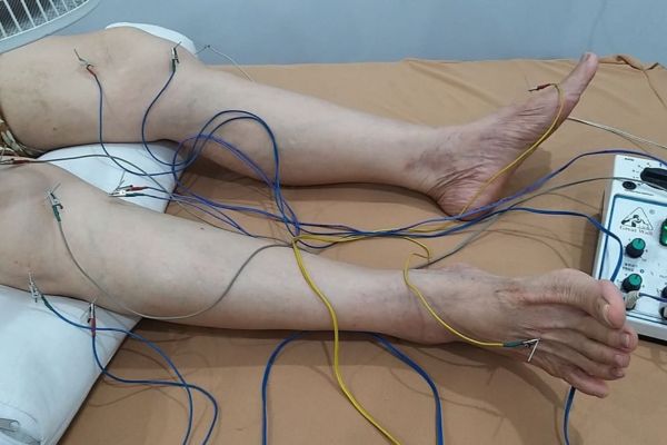 Những phương pháp điều trị phổ biến hiện nay
