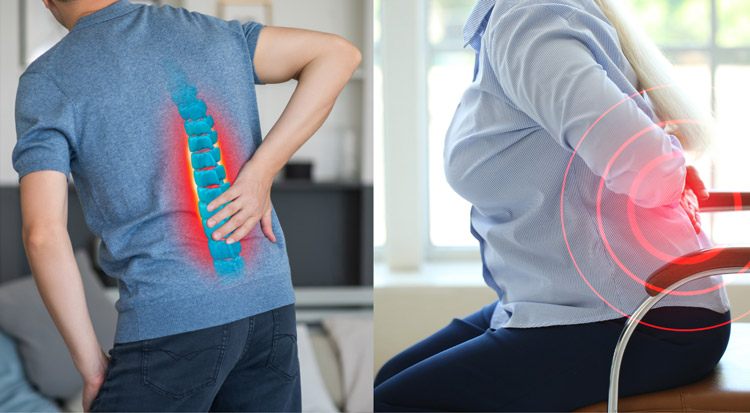 [Cảnh báo] 3+ Dấu hiệu thoát vị đĩa đệm đáng lo ngại!